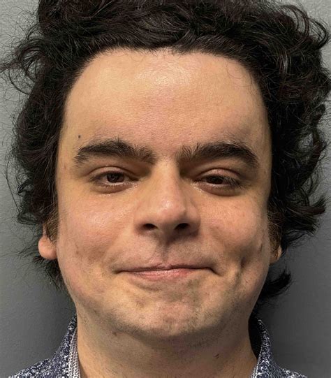 male head widening implant frint 2 Dr Barry Eppley - Explore Plastic