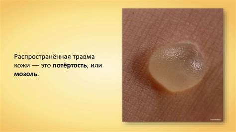 Болезни и травмы кожи - презентация онлайн