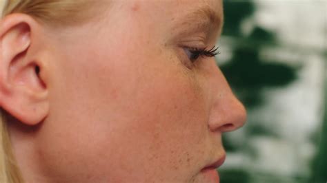 20+ Best Free Pimple 4K Stock Video Footage & Royalty-Free HD Video Clips