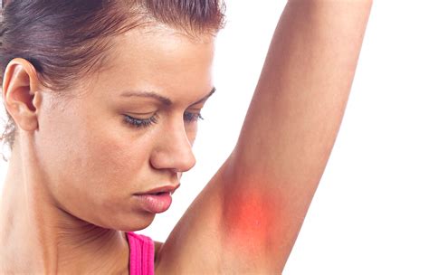 Itchy Armpit Rash Treatment
