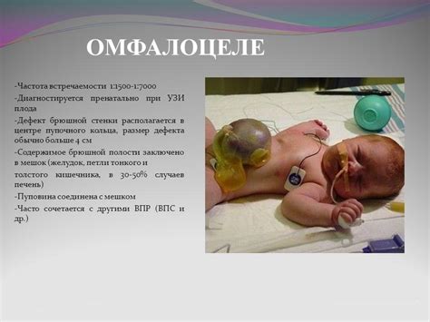 Что такое пупок: научное название, строение, зачем он нужен и как выглядит