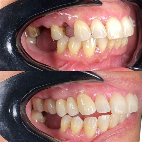 dentes dental clinic imam bonjol bali ao dental directory