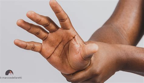 Doença Que Treme A Mão - Tremor de mãos e braços nem sempre é sinal de Parkinson | Dr. Marcos