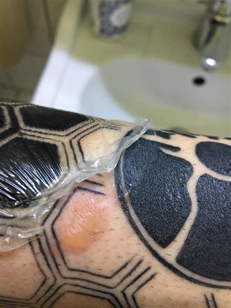 What kind of skin reaction is this? : r/tattoo
