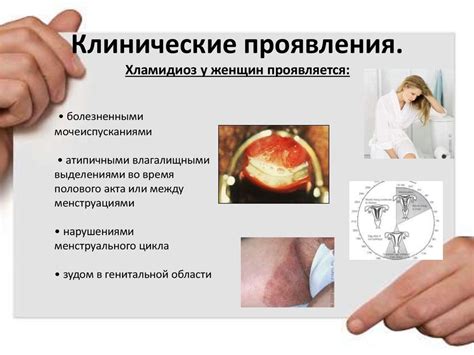 Хламидиоз. Классификация. Причины. Клинические проявления. Лечение ...