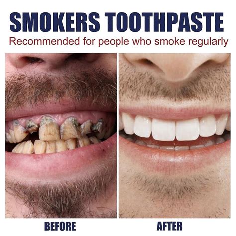 Remove Smoke Stains Toothpaste Smoke Stains Remove Teeth Stains Remove