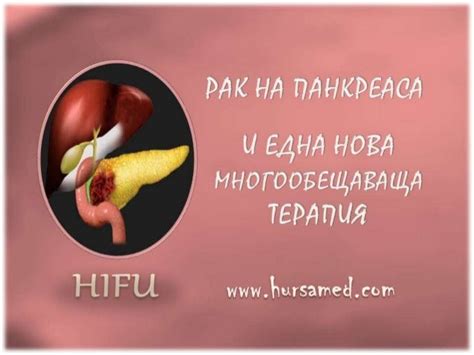 рак на панкреаса