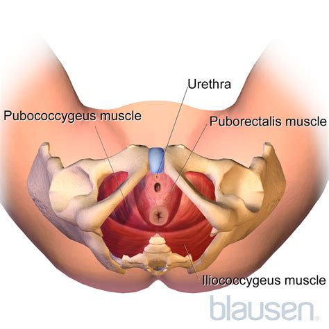 Overview of Pelvic Organ Prolapse (POP) - Gynecology and Obstetrics