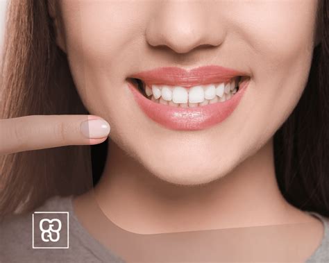 Como Desinflamar Las Encías Al Instante 6