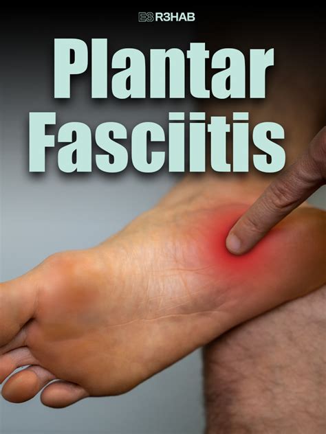 Plantar Fasciitis - E3 Rehab