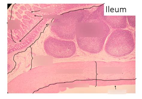 ileum Diagram | Quizlet