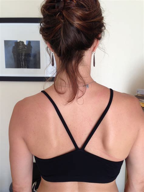 What Should Shoulder Blades Look Like at Sienna Kraegen blog