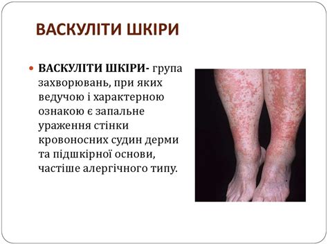 Хвороби шкіри - презентация онлайн