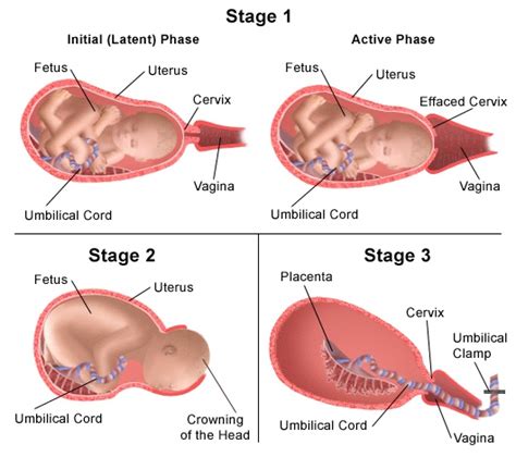 Labor Induction — Denver Holistic Medicine