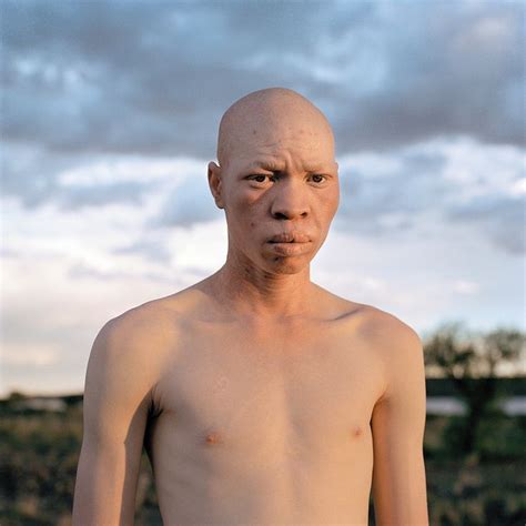 За что альбиносов в Танзании рубят на куски? | Albino men, Albino, Girl ...