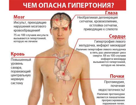 Гипертония 1, 2 и 3 стадии: степени риска, симптомы и лечение
