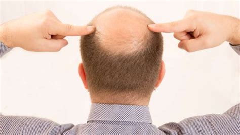 The World's Hottest Bald Man Is . . . - Country 104.7 KKRV