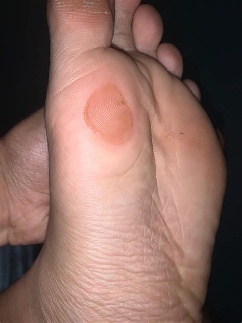 Mit Socken Fußball spielen? (Füße)