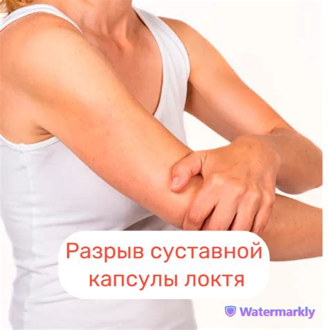 Суставная капсула локтевого сустава: слабые места, разрыв