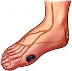 Vascular / Nerve Problems | Foot Problems