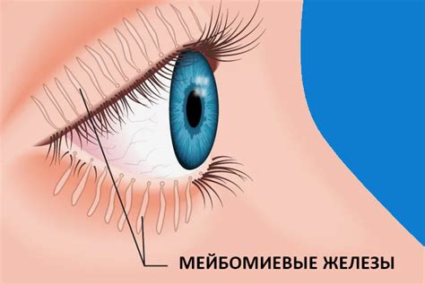 Мейбомиевый блефарит: симптомы и лечение глаз