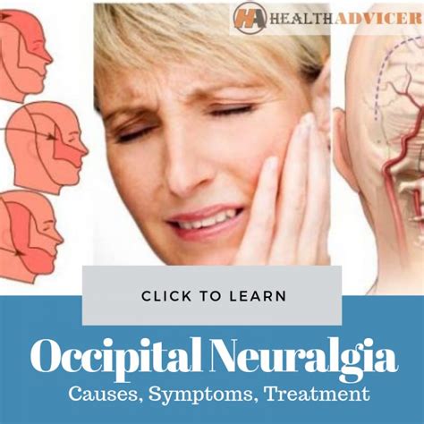 What Is Occipital Neuralgia Occipital Neuralgia Causes Symptoms And ...