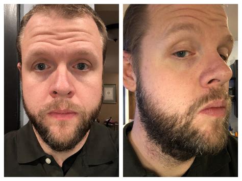 how to trim a beard with hair clippers