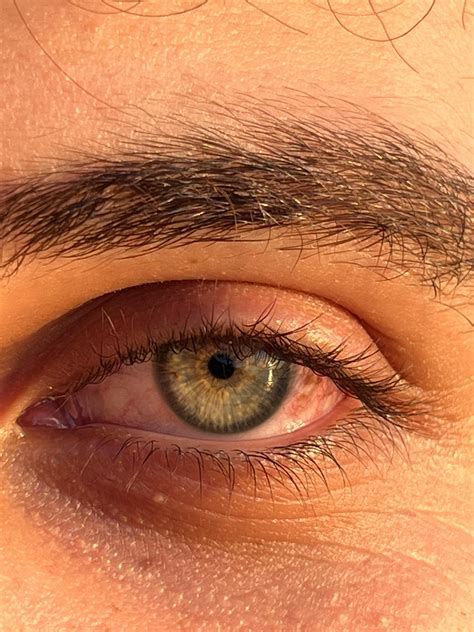 Groin Anatomy Photos, Download The BEST Free Groin Anatomy Stock Photos