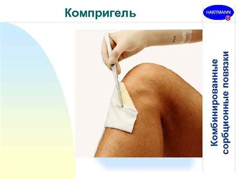 ООО ПАУЛЬ ХАРТМАНН ПЕРЕВЯЗОЧНЫЕ МАТЕРИАЛЫ ПОВЯЗКИ