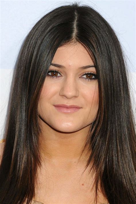 Kylie Jenner Before and After Plastic Surgery Pictures