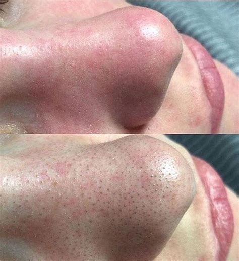 ЧТО НУЖНО ДЕЛАТЬ ЧТОБЫ КОЖА ОСТАВАЛАСЬ ЗДОРОВОЙ ⁉️ Необходимо регулярно ...