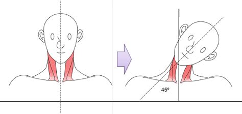 ? Cervical side flexion.