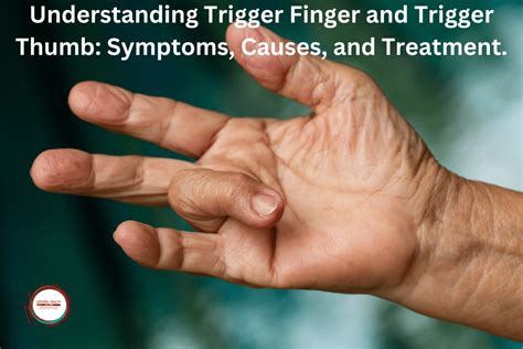 Understanding Trigger Finger and Trigger Thumb: Symptoms, Causes, and ...