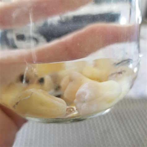 Solution for extracted teeth : r/DentalSchool 