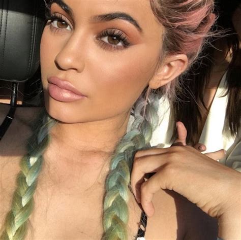 Kylie Jenner before and after plastic surgery | Celebrity | Heat