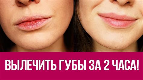 👍 Как быстро восстановить губы? Экспресс вариант за 2 часа! 😲 - YouTube