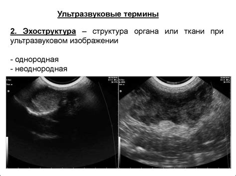 Принципы ультразвукового исследования - презентация онлайн