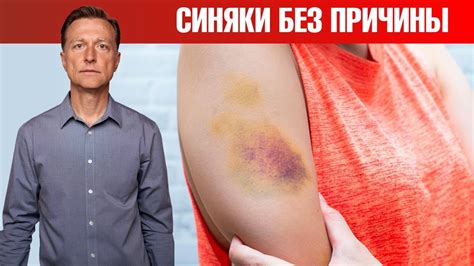 Стадии гематомы мягких тканей и лечение гематом