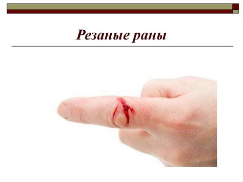 Раны. Ранения - презентация онлайн