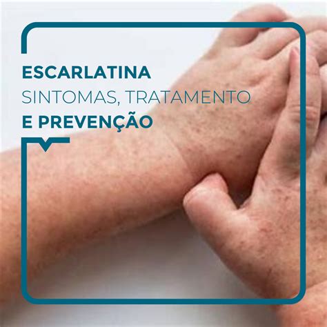 A ESCARLATINA - Alegria Medical Centre