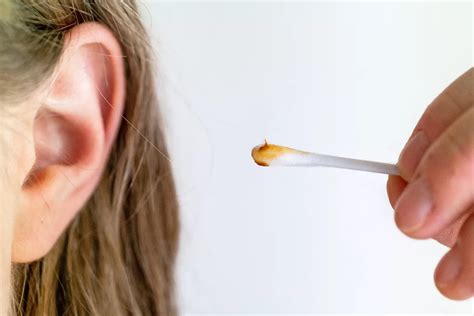 Tapón De Cera-Cerilla-Cerumen