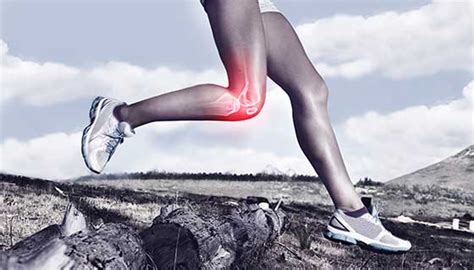 Patellofemoral Pain Syndrome (Runner's Knee) | Johns Hopkins Medicine