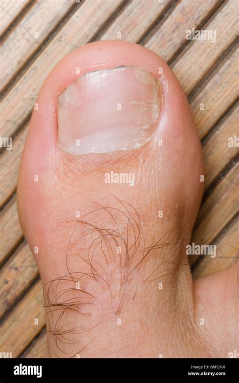 anatomy   foot high resolution stock photography  images alamy