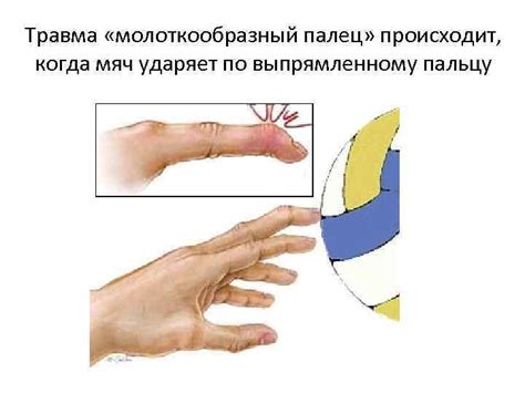 Травмы в ВОЛЕЙБОЛЕ Волейбол занимает последние строчки