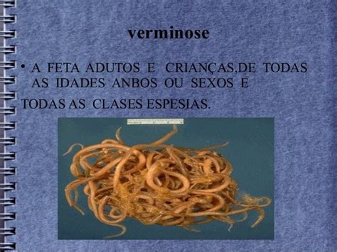 verminose 5º ano "B"