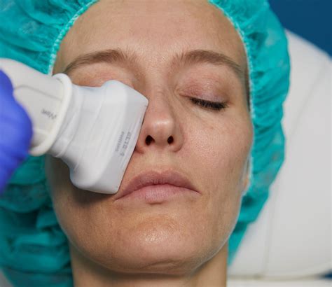 academy anatomy midface cutaneous