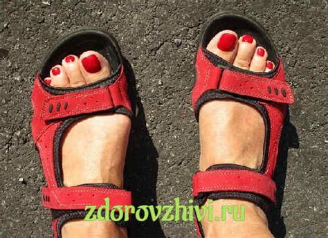 Противогрибковые препараты недорогие, но эффективные: цены