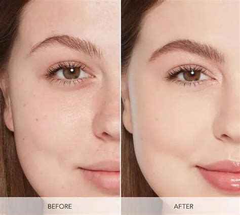 Crioterapia Antes E Depois - Facial con crioterapia: la guía definitiva para una piel radiante