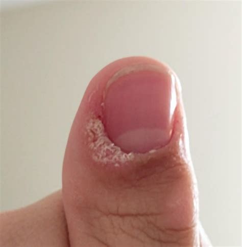 [routine help] any suggestions for my dry thumb cuticle? : r