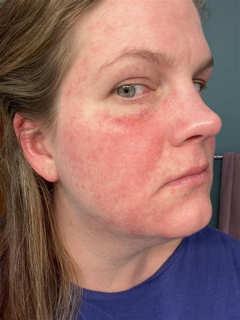 Dermatology report explaining how to fix broken hair from the root 13